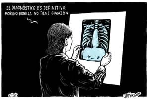 La Junta de Andalucía reconoce graves retrasos en el diagnóstico de cáncer de mama